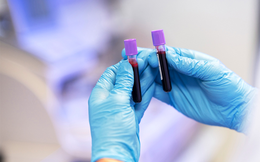 Platelet-Rich Plasma Injections