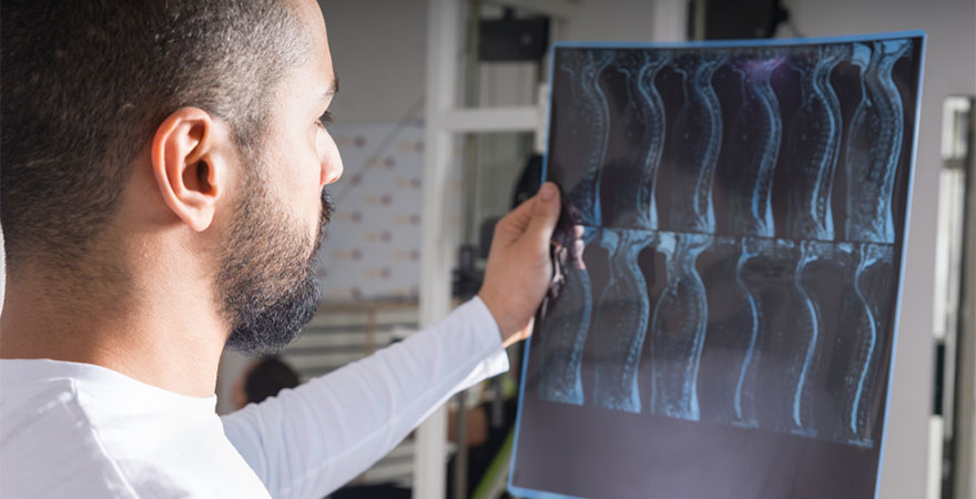 Could Spinal Cord Stimulation Be the Answer to Your Pain?