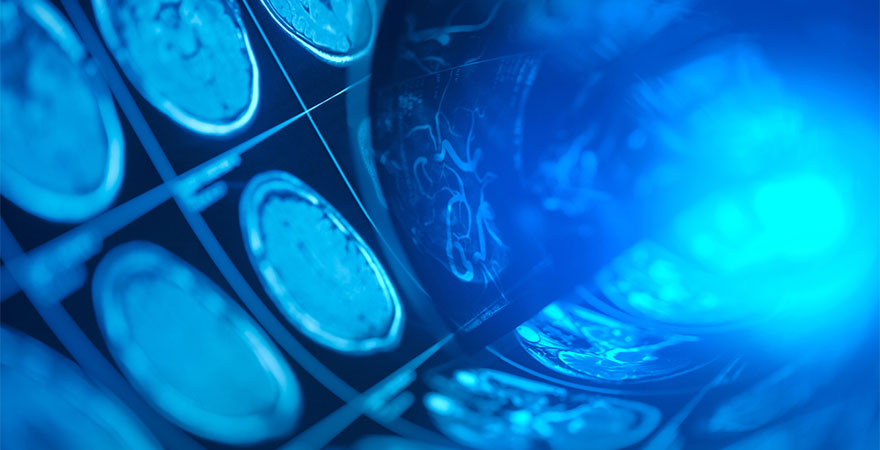 Understanding and Treating Headaches: Beyond Temporary Relief