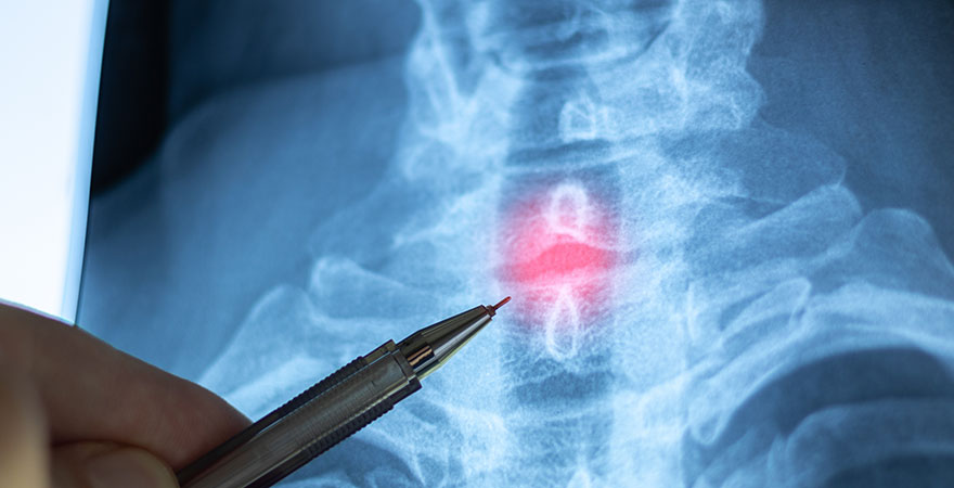 New Pain Management & TBI Clinics Open in Long Beach and Santa Ana