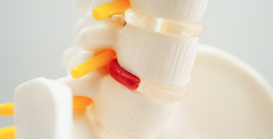 How Spinal Injections Treat Back Pain at Its Source
